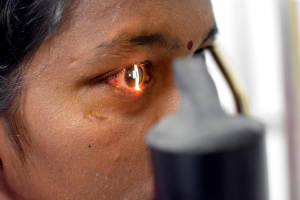 Retina Specialist
