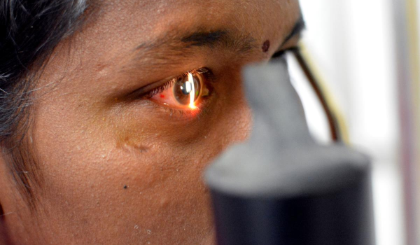 Prevention for Cataract Surgery _